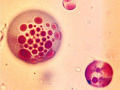 microencapsulation
